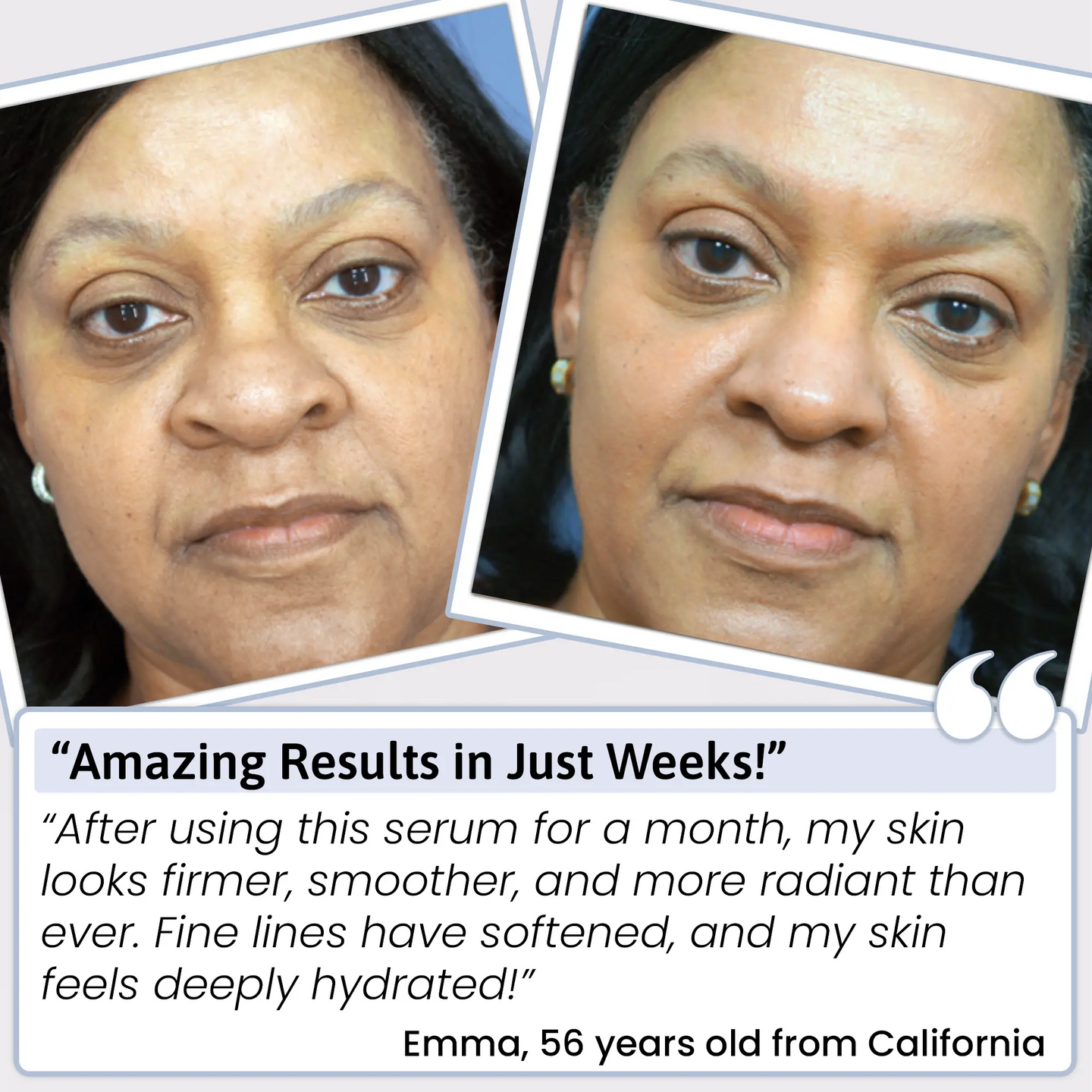 PUREHYALURONIC® 3% Hyaluronic Acid Serum