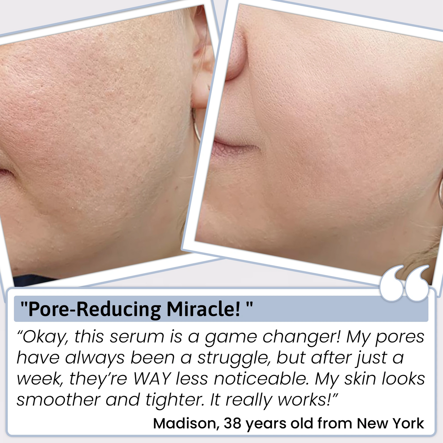 PUREHYALURONIC® 3% Hyaluronic Acid Serum