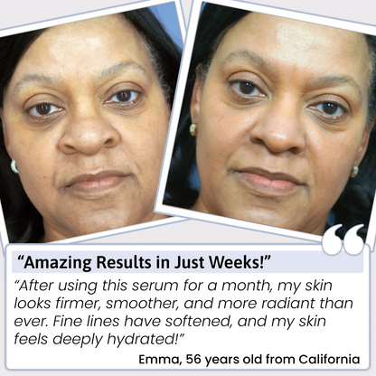 PUREHYALURONIC® 3% Hyaluronic Acid Serum