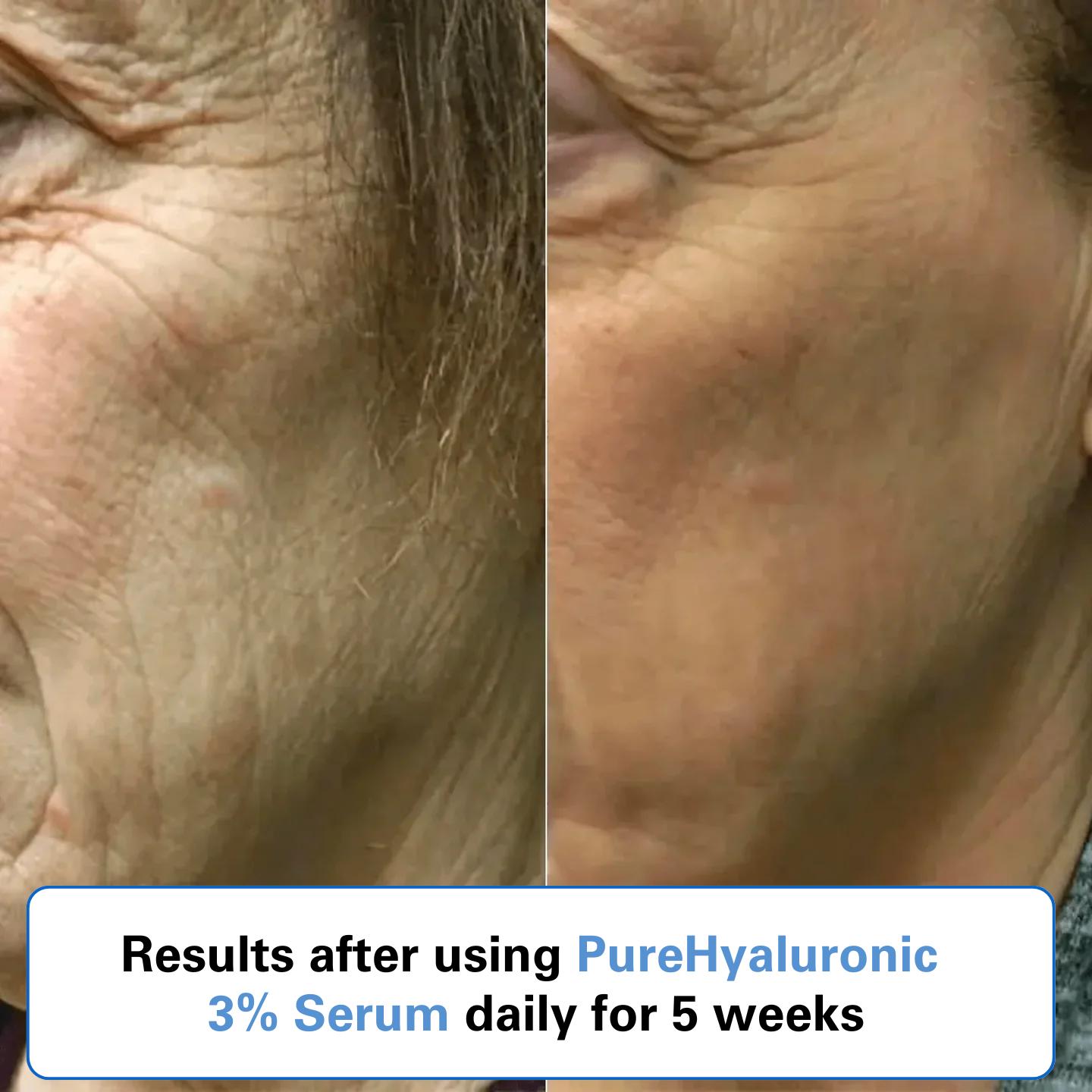 PUREHYALURONIC® 3% Hyaluronic Acid Serum